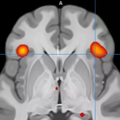 Centre for Cognitive & Clinical Neuroscience 🧠
