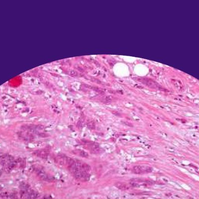 Breast Pathology Research Group